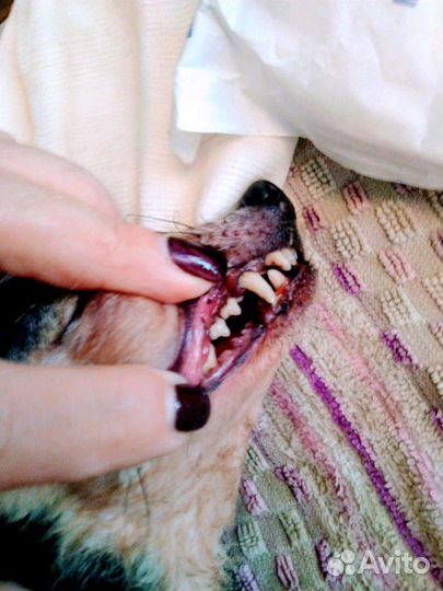 Ультразвуковая чистка зубов без стресса