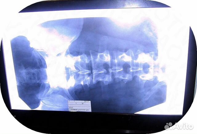 Школьный самодельный экран для просмотра негативов