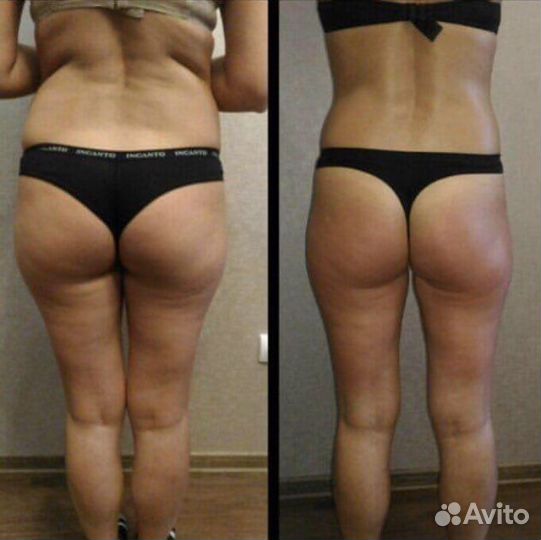 Массаж лица и тела