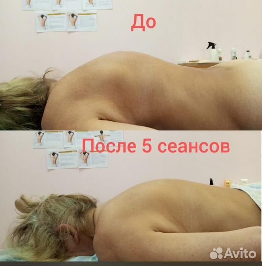 Приборы/аппараты для коррекции фигуры