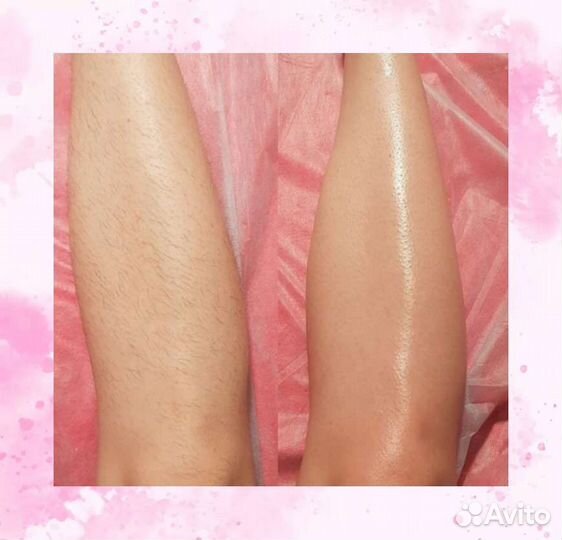 Шугаринг сахарной пастой