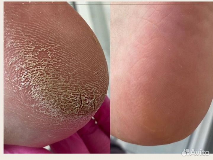 Маникюр, педикюр