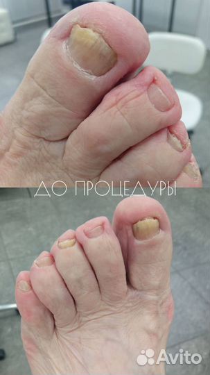 Услуги мастера педикюра, подолог