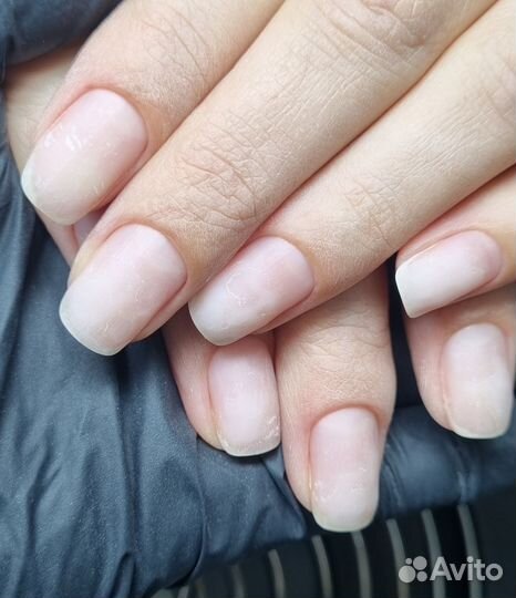 Восстановление ногтей