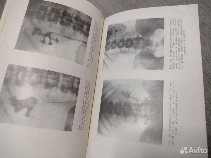 Книга по медицине. Камни почек и мочеточников