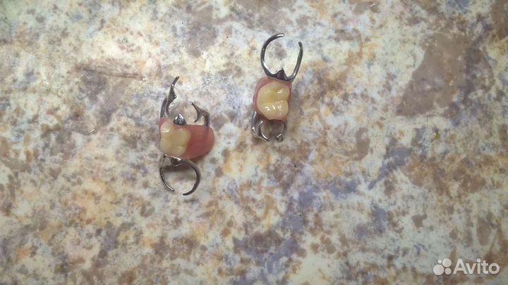 Протезирование зубов с выездом на дом