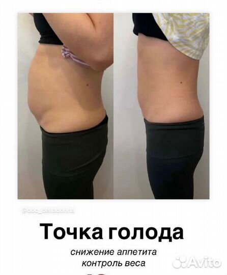 Липолитик, топим жир