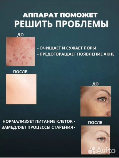 Аппарат для чистки лица