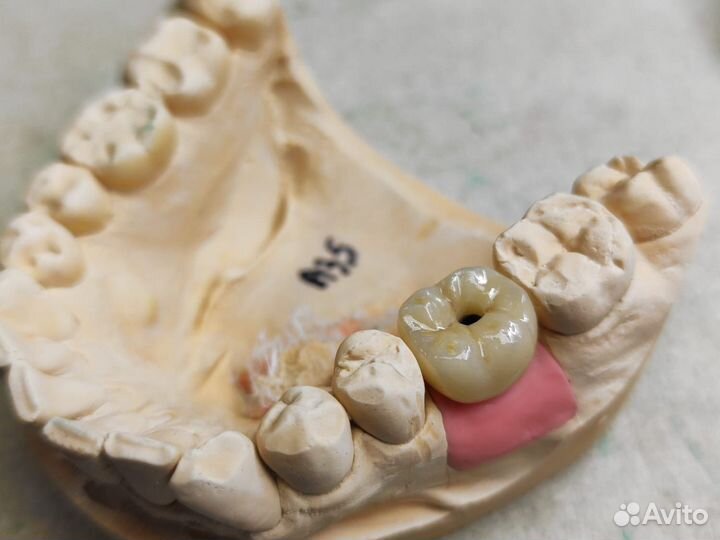 Услуги для зуботехнической лаборатории и техников