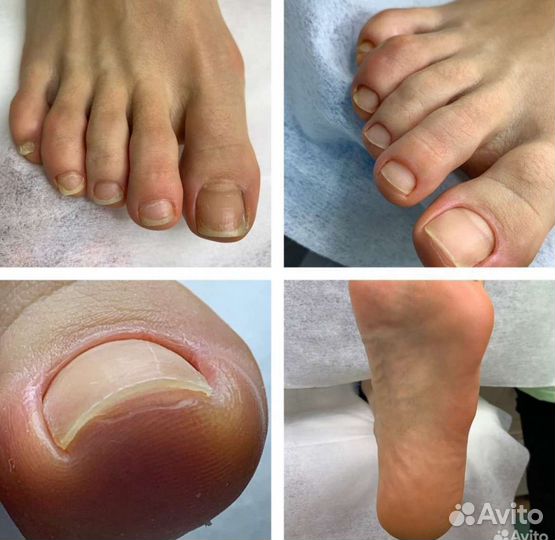 Маникюр педикюр на дому