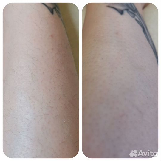 Депиляция Шугаринг, Воск