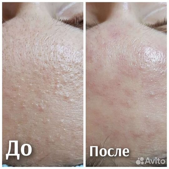 Услуги косметолога косметолог