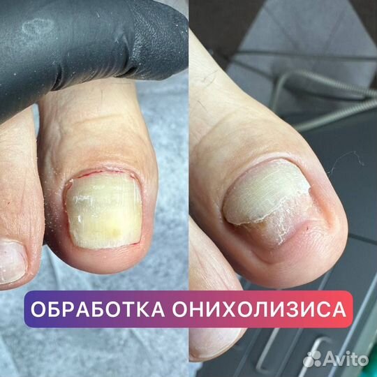 Лечебный педикюр подолог маникюр