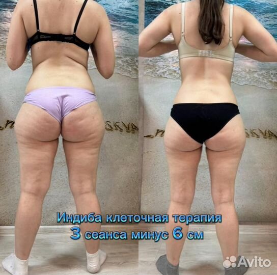 Массаж/Индиба