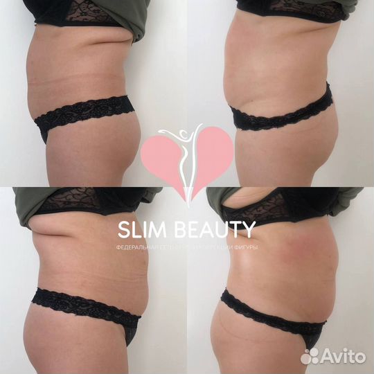 Похудение до 10 кг за курс