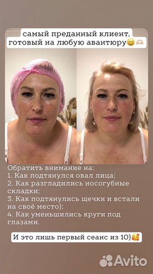 Лифтинг массаж лица