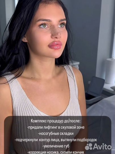 Косметолог увеличение губ ботокс био