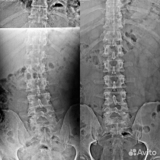 Костоправ Иваново (Виктор)