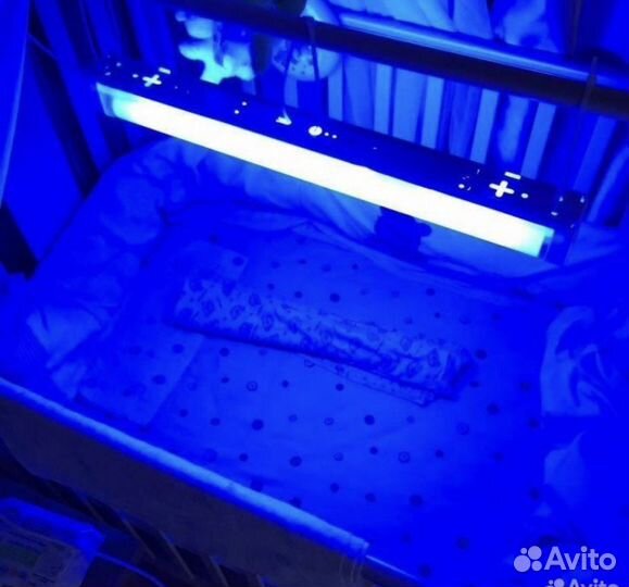 Уф лампа от желтушки