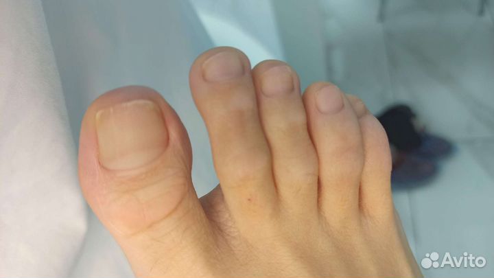 Педикюр подолог