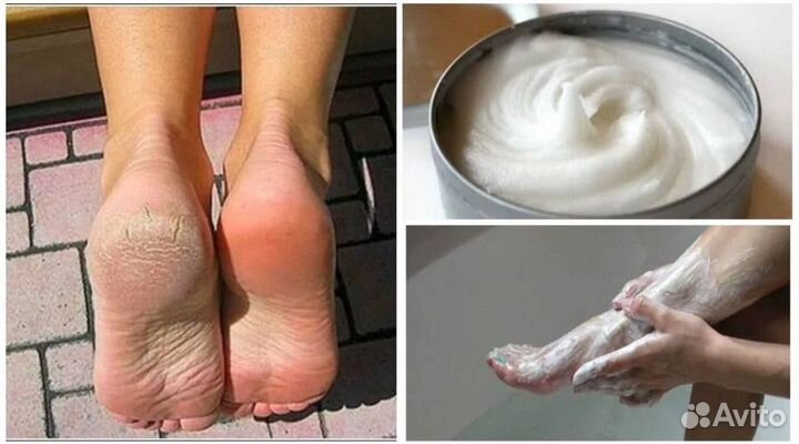 Актилайн - средство убирает грибок кожи и ногтей