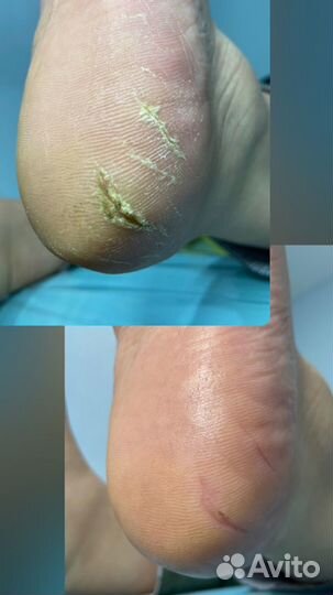 Подологический педикюр и маникюр