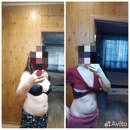 Криолиполиз