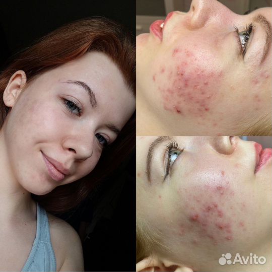Врач косметолог, дерматолог, трихолог