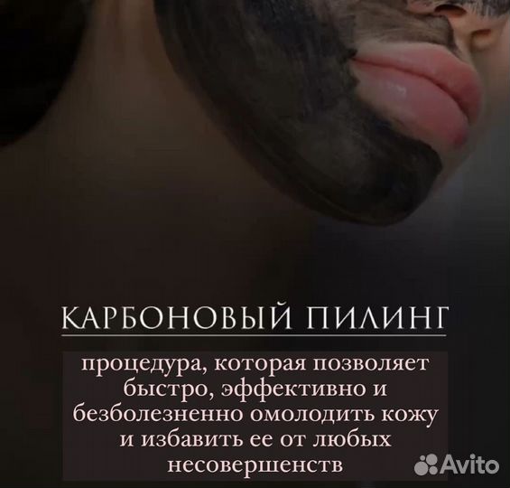 Лазерная эпиляция