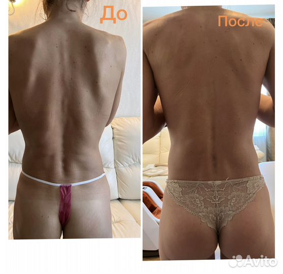 Виски-пеленание styx,гелевое обертывание cello-GEL