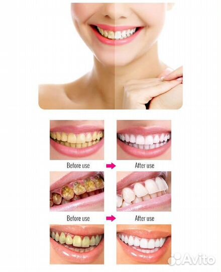 Отбеливающая эссенция для зубов OMY lady