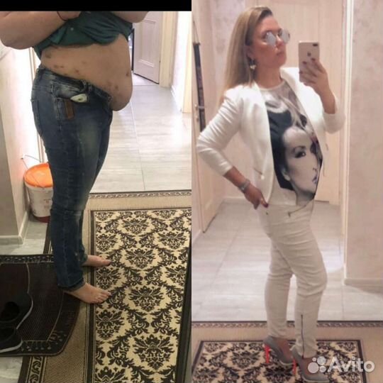 Аппаратный массаж.Похудеть за 16 дней