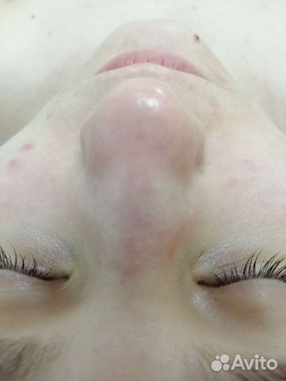 Чистка лица на новом Израильском бренде ProMe