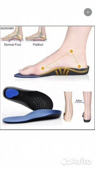 Детские ортопедические стельки