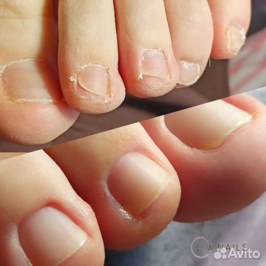 Педикюр, покрытие гель-лак, модель