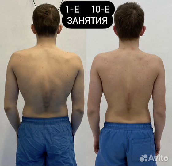 Здоровая спина,осанка,оздоровление спины