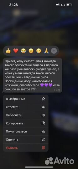 Лазерная эпиляция