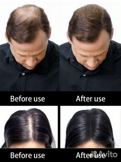 Пудра для густоты волос (маскирующая залысины)