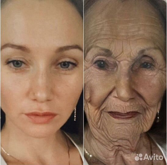 Омоложение лица