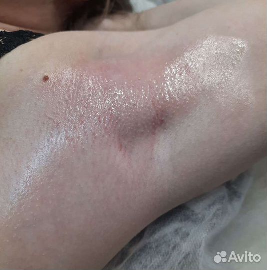 Шугаринг Депиляция Ваксинг