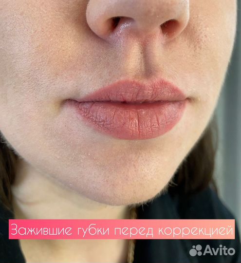 Перманентный макияж/татуаж/лазерное удаление