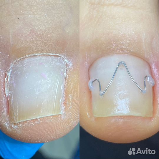 Педикюр, Подолог