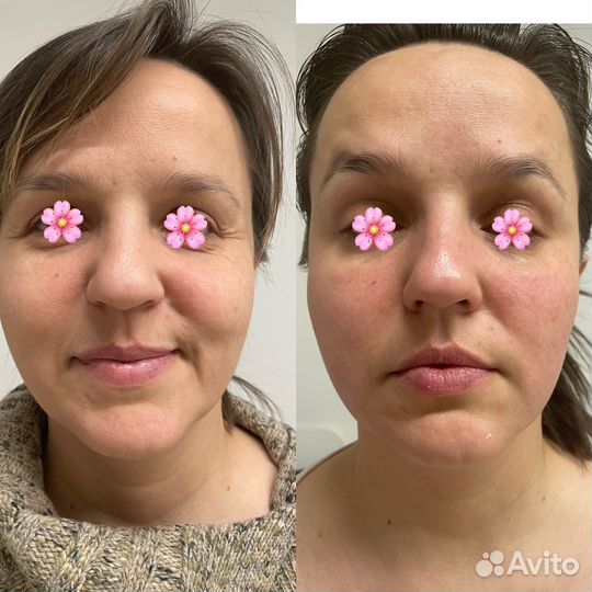 Массаж лица и тела только женщинам