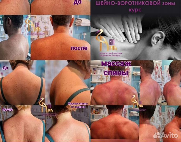 Массаж спины и шейно-воротниковой зоны