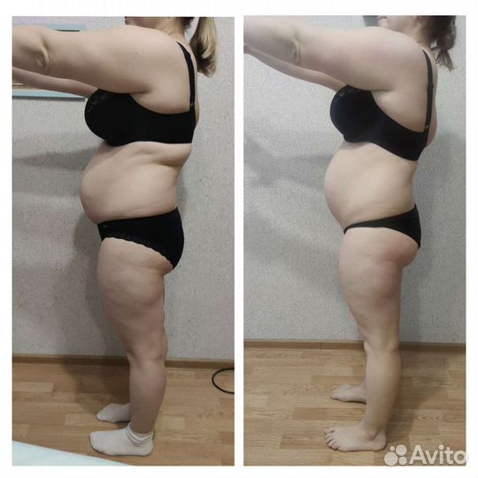 Антицеллюлитный массаж, лимфодренажный массаж