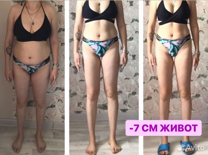 Ручная липосакция