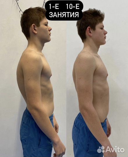 Здоровая спина,осанка,оздоровление спины