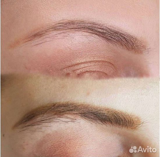 Удаление тату/татуажа