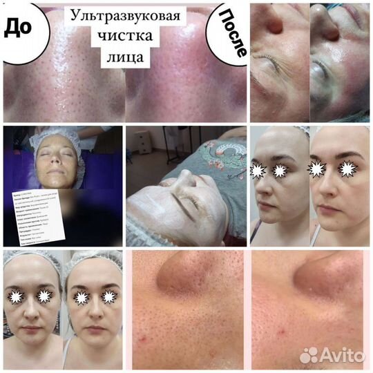 Косметология для Вас