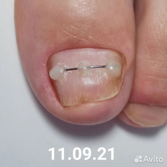 Подолог, педикюр, маникюр